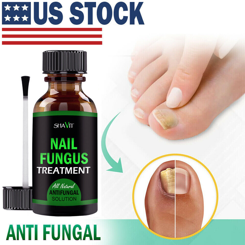 Toenail And Fingernail Fungus Treatment Extra Strength Antifungal Athletes Foot - Image 9