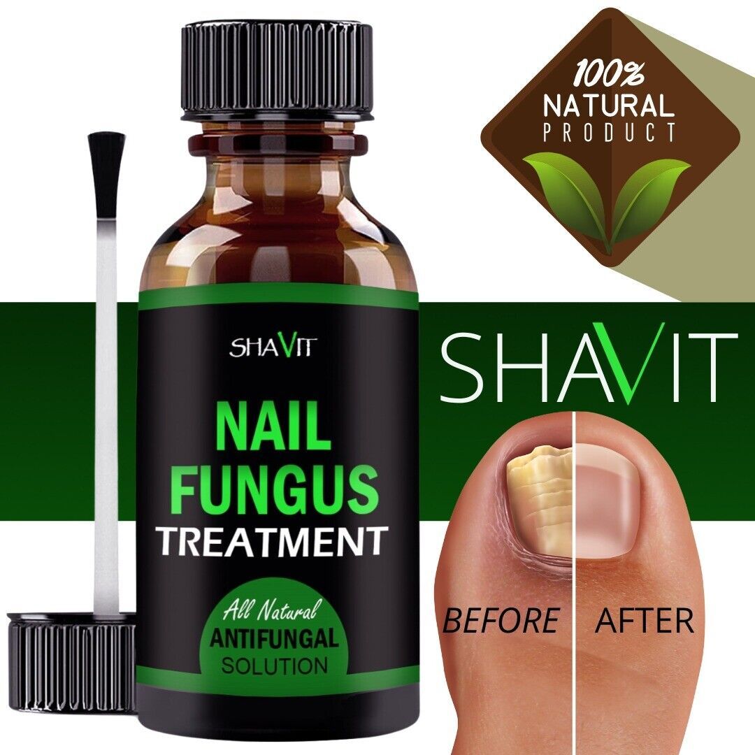 Toenail And Fingernail Fungus Treatment Extra Strength Antifungal Athletes Foot - Image 10
