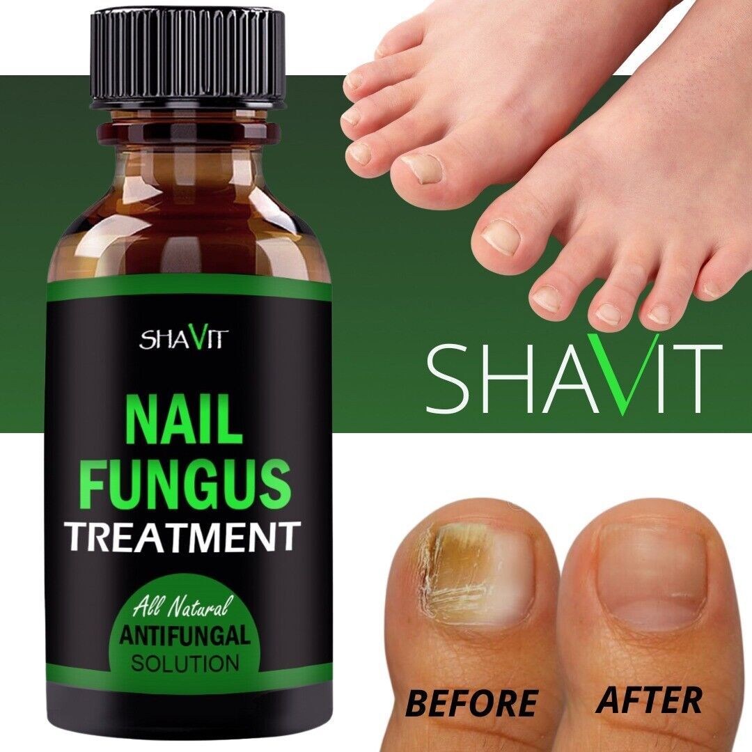 Toenail And Fingernail Fungus Treatment Extra Strength Antifungal Athletes Foot - Image 7