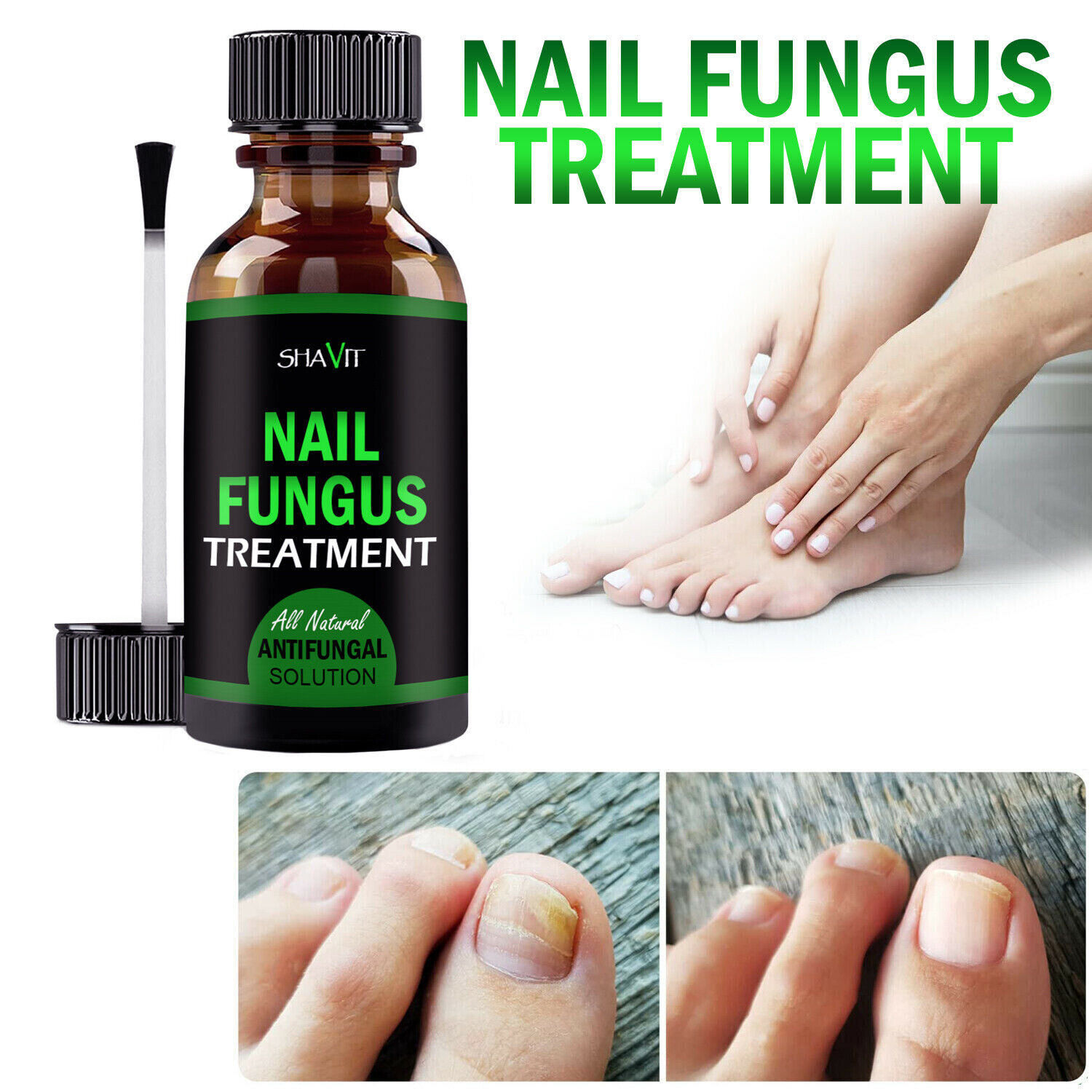 Toenail And Fingernail Fungus Treatment Extra Strength Antifungal Athletes Foot - Image 5
