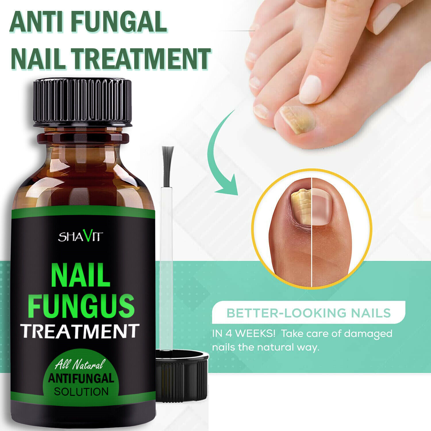 Toenail And Fingernail Fungus Treatment Extra Strength Antifungal Athletes Foot - Image 4