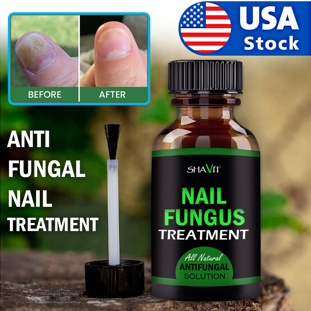 Toenail And Fingernail Fungus Treatment Extra Strength Antifungal Athletes Foot - Image 3